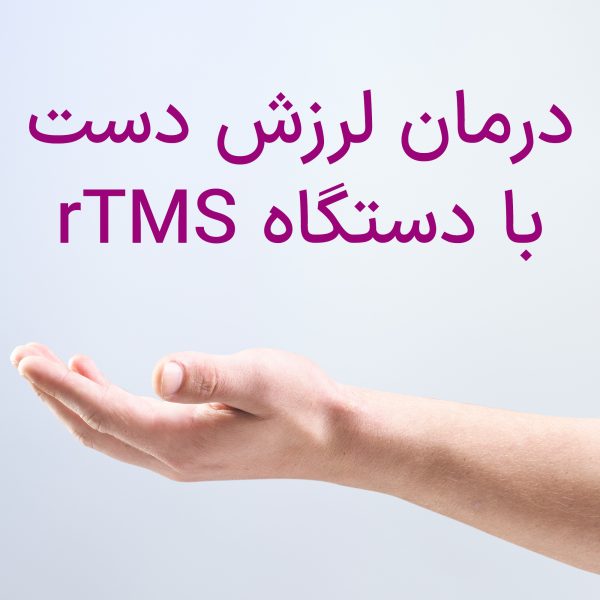 درمان لرزش دست با دستگاه rTMS
