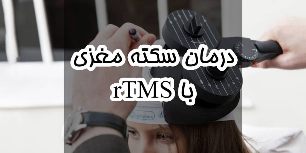 تصویر شاخص درمان سکته مغزی با آر تی ام اس