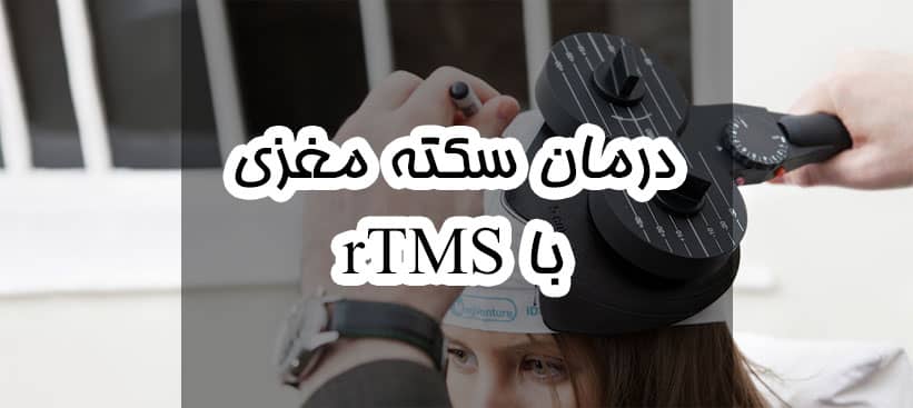 درمان سکته مغزی با rTMS