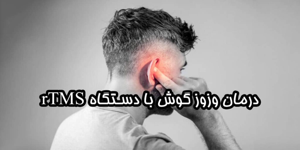 دستگاه rTMS برای وزوز گوش